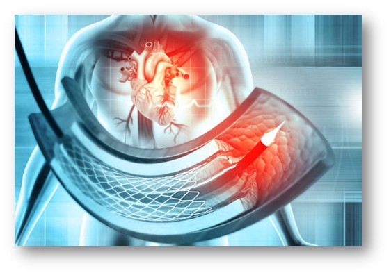 State-of-the-art Cardiac Equipment
